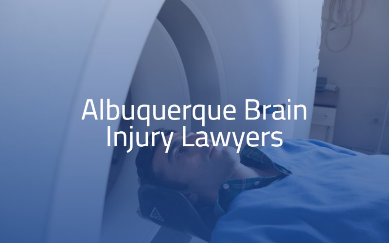 Car Accidents Can Cause Traumatic Brain Injuries - Miami Car Accident Lawyer